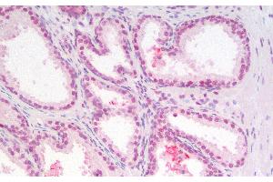 Immunohistochemistry analysis of paraffin-embedded Human Prostate using p27 Polyclonal Antibody. (CDKN1B anticorps)