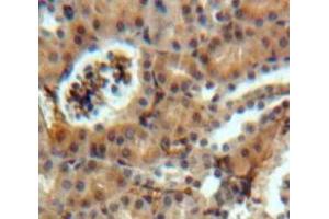 Used in DAB staining on fromalin fixed paraffin-embedded Kidney tissue (SOSTDC1 anticorps  (AA 24-206))