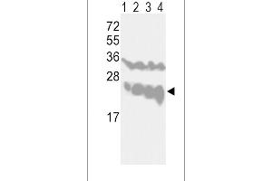 Western blot analysis of UCHL1-V31 (ABIN388868 and ABIN2839164) in CEM(lane 1), Jurkat(lane 2), Y79(lane 3) cell line and mouse brain tissue(lane 4) lysates (35 μg/lane).