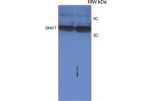 Western Blot detection of SHMT protein in Arabidopsis thaliana leaf extract, loaded on a leaf disc area. (SHMT1 anticorps)