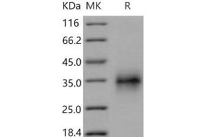 Western Blotting (WB) image for Tumor Necrosis Factor Receptor Superfamily, Member 1A (TNFRSF1A) (Active) protein (His tag) (ABIN7320255)
