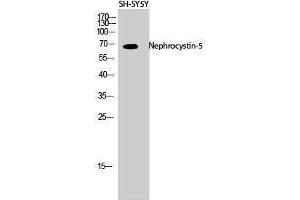 Western Blotting (WB) image for anti-IQ Motif Containing B1 (IQCB1) (Internal Region) antibody (ABIN3185822) (IQCB1 anticorps  (Internal Region))
