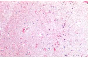 Immunohistochemistry staining of human cortex (paraffin-embedded sections) with anti-CD142 (HTF-1), 10 μg/mL.