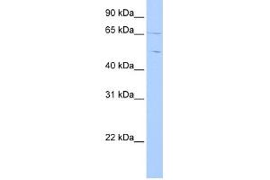 WB Suggested Anti-CPNE4 Antibody Titration: 0. (Copine IV anticorps  (C-Term))