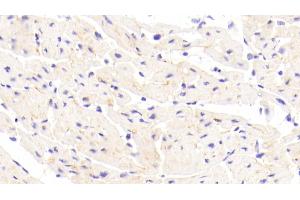 Detection of CDHH in Human Cardiac Muscle Tissue using Polyclonal Antibody to Cadherin, Heart (CDHH)