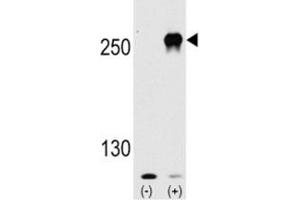 Western blot analysis of mTOR antibody and 293 cell lysate (2 ug/lane) either nontransfected (Lane 1) or transiently transfected with the mTOR gene (2).