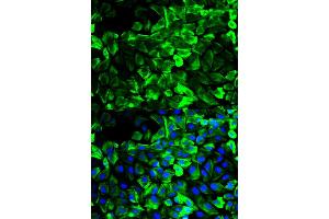 Immunofluorescence analysis of HeLa cells using TPM1 antibody (ABIN2989338). (Tropomyosin anticorps)