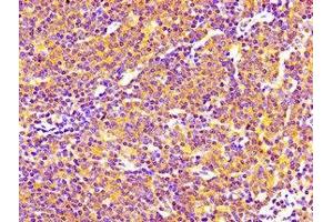 Immunohistochemistry of paraffin-embedded human lymph node tissue using ABIN7169699 at dilution of 1:100 (SIPA1 anticorps  (AA 759-927))