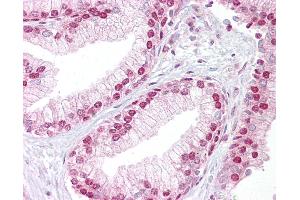 Anti-TCEA1 antibody IHC of human prostate. (TCEA1 anticorps  (AA 71-120))