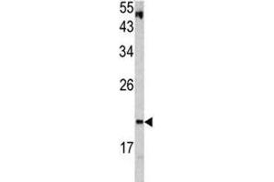 Western blot analysis of VHL antibody and HepG2 lysate. (VHL anticorps  (AA 181-210))