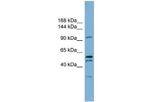 WB Suggested Anti-ANO6 Antibody Titration:  0. (Anoctamin 6 anticorps  (C-Term))