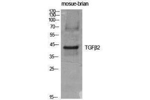 Western Blotting (WB) image for anti-Transforming Growth Factor, beta 2 (TGFB2) (C-Term) antibody (ABIN3187250) (TGFB2 anticorps  (C-Term))