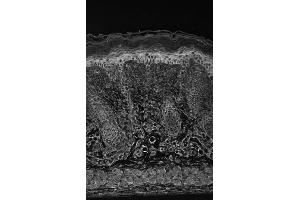 HIF1 alpha Immunohistochemistry.