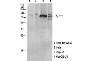 Western Blot (WB) analysis of specific cells using Antibody diluted at 1:1000. (MAPKAP Kinase 5 anticorps  (pThr182))