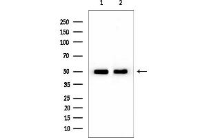 anti-Cholecystokinin A Receptor (CCKAR) (Internal Region) antibody