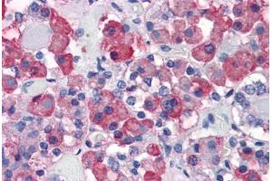 Anterior pituitary: Formalin-Fixed, Paraffin-Embedded (FFPE) (Growth Hormone 1 anticorps)