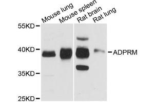 Western blot analysis of extracts of various cell lines, using ADPRM antibody. (ADPRM anticorps)