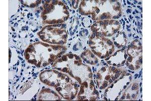 Immunohistochemical staining of paraffin-embedded Human Kidney tissue using anti-GCKR mouse monoclonal antibody.