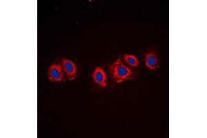 Immunofluorescent analysis of PDGFR alpha staining in NIH3T3 cells. (PDGFRA anticorps  (C-Term))