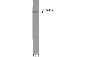 Western blot analysis of FAK on a A431 cell lysate (Human epithelial carcinoma, ATCC CRL-1555). (FAK anticorps  (AA 354-533))