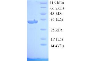 SDS-PAGE (SDS) image for Plasminogen Activator, Urokinase (PLAU) (AA 25-299) protein (His tag) (ABIN5713738)