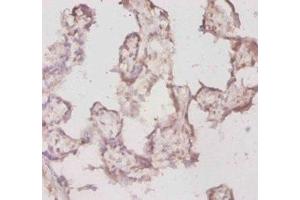 Immunohistochemistry of paraffin-embedded human placenta tissue using ABIN7177935 at dilution of 1:20 (TPT1 anticorps  (AA 1-172))