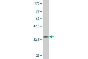 Western Blot detection against Immunogen (36. (ALAS1 anticorps  (AA 1-98))