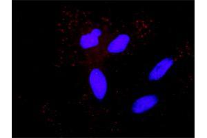Proximity Ligation Analysis of protein-protein interactions between MAP3K5 and APP.