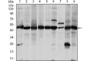Western Blotting (WB) image for anti-Argininosuccinate Synthase 1 (ASS1) antibody (ABIN1105454) (ASS1 anticorps)