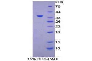 SDS-PAGE analysis of Human ATP6AP2 Protein. (ATP6AP2 Protéine)