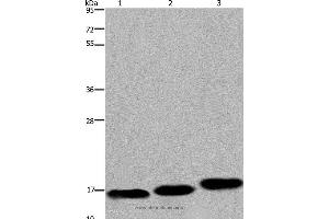 Western blot analysis of Mouse skeletal muscle, heart and bladder tissue, using MYL12B Polyclonal Antibody at dilution of 1:550 (MYL12B anticorps)