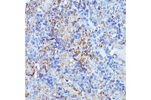 Immunohistochemistry of paraffin-embedded rat spleen using Septin 1 antibody (ABIN7270202) at dilution of 1:100 (40x lens). (Septin 1 anticorps  (AA 270-370))