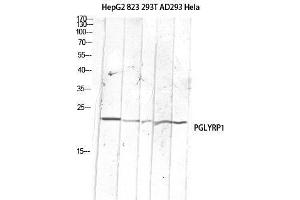 Western Blot (WB) analysis of HepG2 823-AV 293T AD293 HeLa lysis using PGLYRP1 antibody. (PGLYRP1 anticorps)