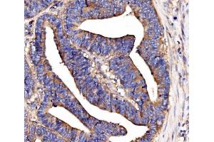 IHC analysis of SCRN1 using anti-SCRN1 antibody (ABIN7602923). (Secernin 1 anticorps  (C-Term))