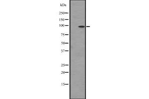 Western blot analysis of DDR2 expression in Hela cell lysate,The lane on the left is treated with the antigen-specific peptide. (DDR2 anticorps  (Internal Region))