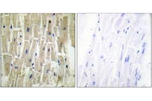 Immunohistochemistry analysis of paraffin-embedded human heart tissue, using PDLIM1 Antibody.