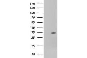 Western Blotting (WB) image for anti-Four and A Half LIM Domains 1 (FHL1) antibody (ABIN1500977) (FHL1 anticorps)