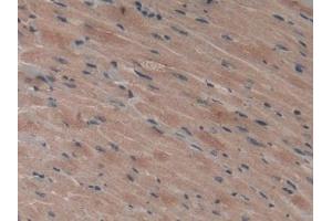 Detection of VEGFC in Mouse Heart Tissue using Polyclonal Antibody to Vascular Endothelial Growth Factor C (VEGFC)