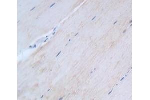 Used in DAB staining on fromalin fixed paraffin- embedded Kidney tissue