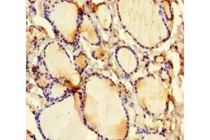 Immunohistochemistry of paraffin-embedded human thyroid tissue using ABIN7153665 at dilution of 1:100 (Non-Syndromic Hearing Impairment Protein 5 (GSDME) (AA 1-496) anticorps)