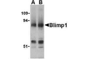 Western blot analysis of Blimp-1 in mouse lung tissue lysate with AP30155PU-N Blimp-1 antibody at (A) 0. (PRDM1 anticorps  (N-Term))