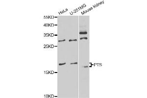 Western blot analysis of extracts of various cell lines, using PTS antibody (ABIN6291724) at 1:1000 dilution.