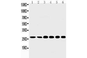 Anti-Sonic Hedgehog antibody,  Western blotting Lane 1: Rat Liver Tissue Lysate Lane 2: Rat Intestine Tissue Lysate Lane 3: HELA Cell Lysate Lane 4: A549 Cell Lysate Lane 5: SMMC Cell Lysate Lane 6: MM231 Cell Lysate