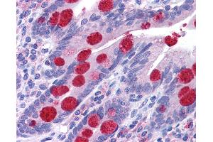 Anti-ZCRB1 antibody IHC of human small intestine.