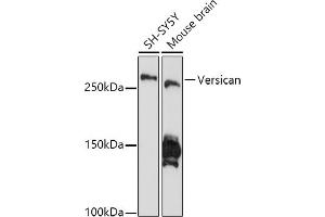 Western blot analysis of extracts of various cell lines, using Versican antibody (ABIN7271309) at 1:1000 dilution. (Versican anticorps)