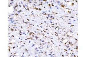 IHC analysis of FGF2 using anti-FGF2 antibody (ABIN7603215). (FGF2 anticorps  (N-Term))