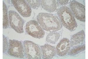 Immunohistochemistry (Formalin/PFA-fixed paraffin-embedded sections) of mouse testis with Slc25a19 polyclonal antibody . (SLC25A19 anticorps)