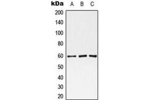 Western blot analysis of Monoamine Oxidase A expression in HEK293T (A), Raw264. (Monoamine Oxidase A anticorps  (Center))