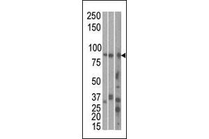 The anti-MARK1 C-term Pab is used in Western blot to detect MARK1 in, from left to right, Hela, T47D, and mouse brain cell line/ tissue lysate.