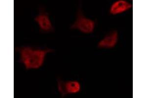 ABIN6274561 staining HeLa by IF/ICC. (EID1 anticorps  (Internal Region))
